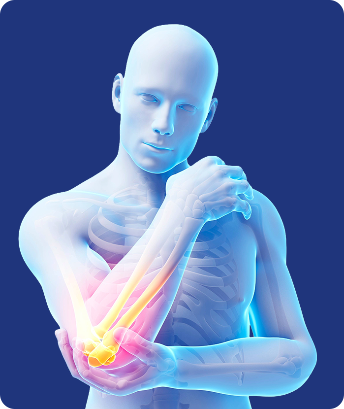 팔꿈치 내·외측 상과염