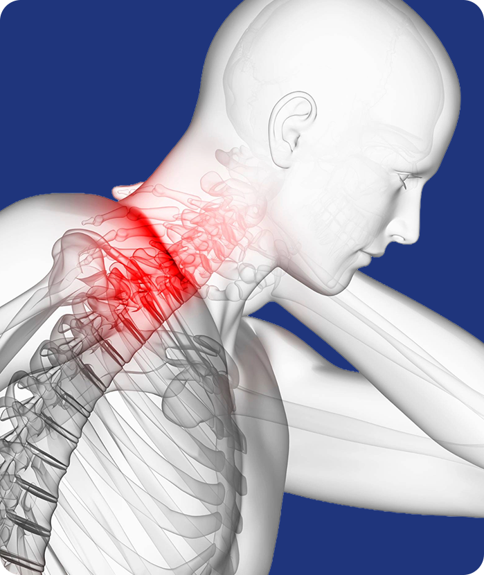 후종인대골화증